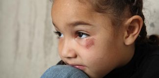 Case study: How would you react to injury at school